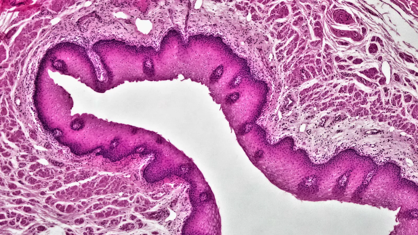 A pink and purple stained tissue slide showing a folded band of stratified squamous epithelium around a white lumen