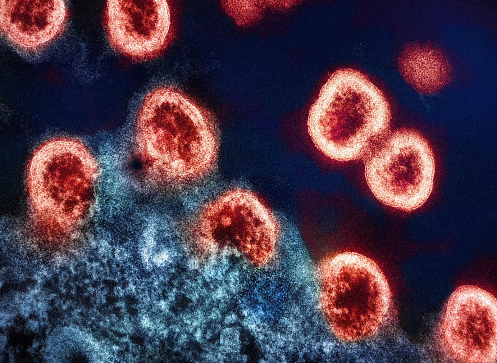 A colourised electron microscope image of round orange virus particles next to the blue surface of a cell