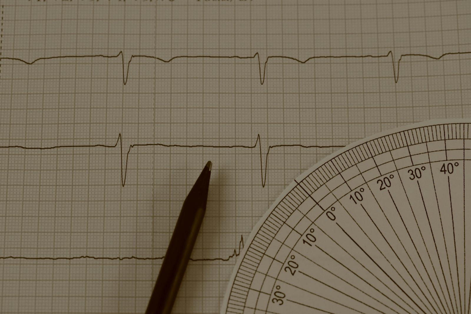 EKG lesen lernen: in sechs Schritten zum sicheren Befund