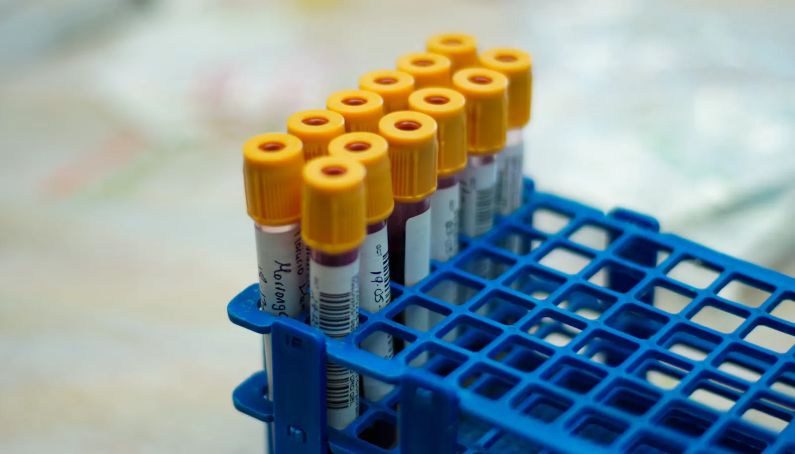 Blood sample tubes with yellow caps standing in a blue laboratory rack