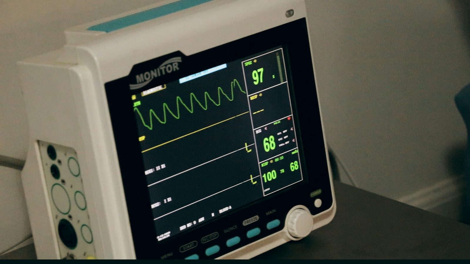 EKG anlegen: Elektroden richtig kleben mit Eselsbrücke