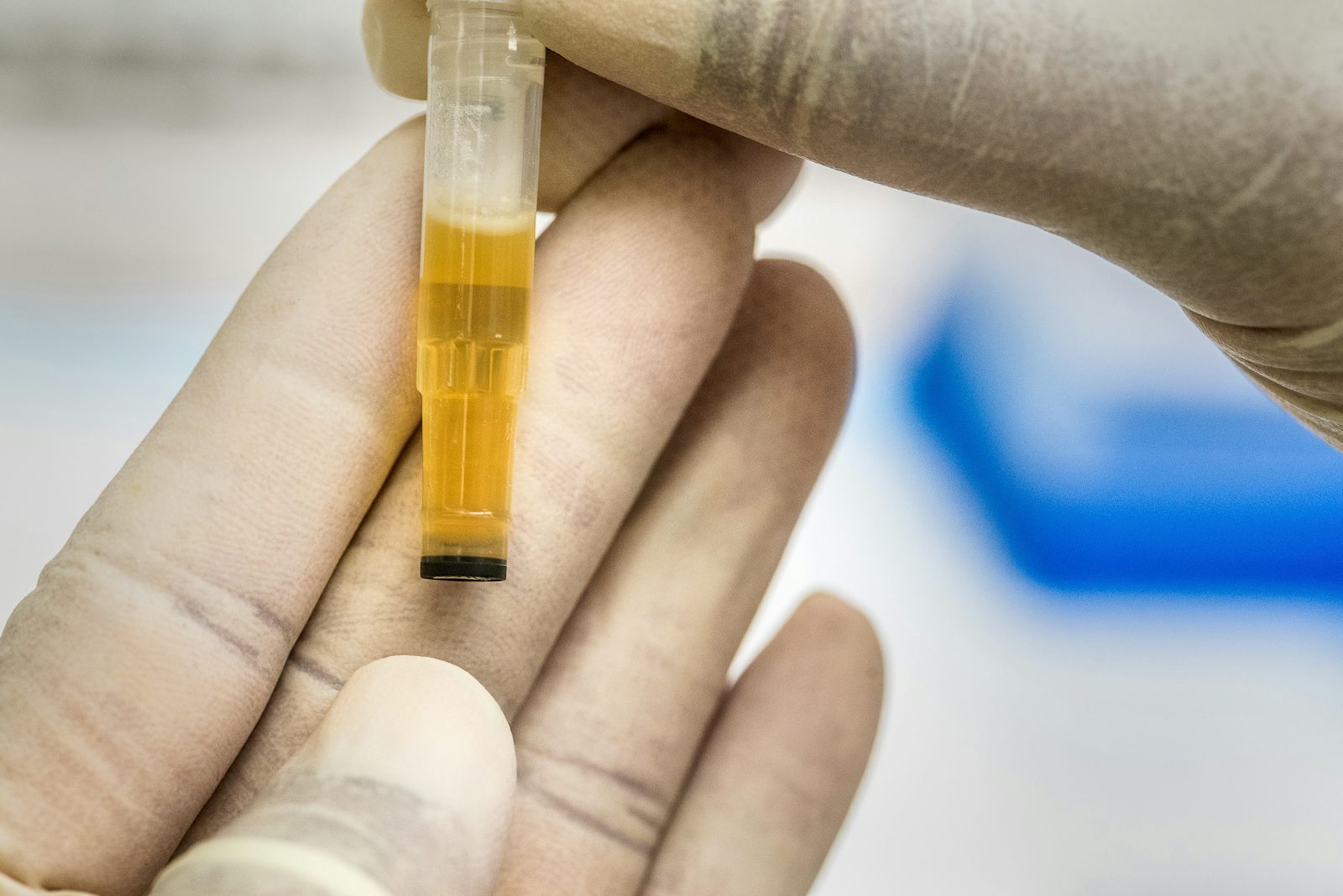 Harnstoffzyklus einfach erklärt: Schritte, Enzyme, Merkhilfe