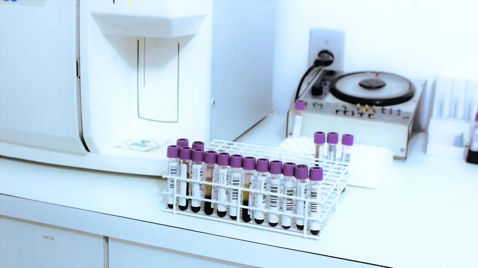 Laboratory bench with a rack of blood sample tubes