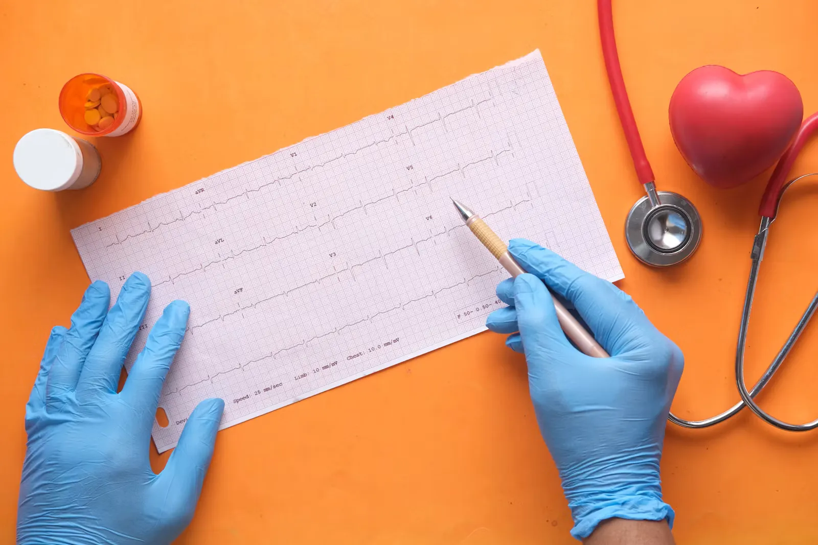 Behandschuhte Haende markieren einen EKG-Streifen auf orangefarbenem Untergrund, daneben liegen ein Stethoskop, eine Tablettendose und ein rotes Herzmodell