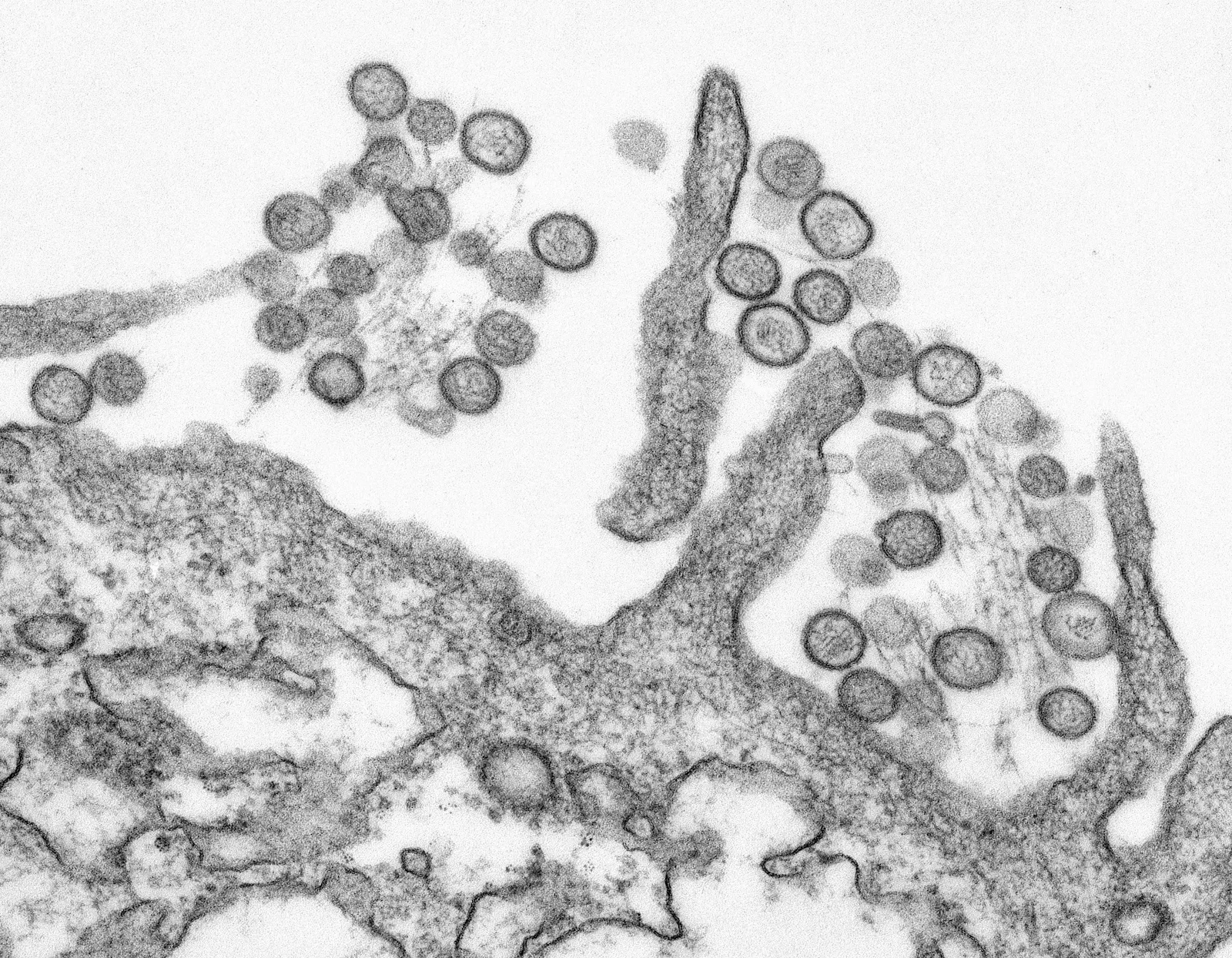 Elektronenmikroskopische Schwarzweissaufnahme von runden Viruspartikeln, die aus einer Zellmembran knospen, Sinnbild für Viren, gegen die die Masern-Impfung schützt